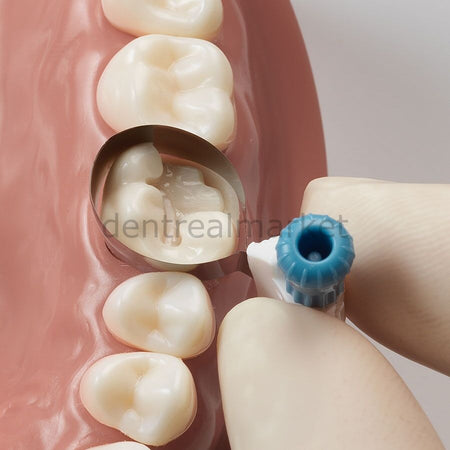 Dentsply-Sirona Palodent 360 Circumferential Matrix Refill