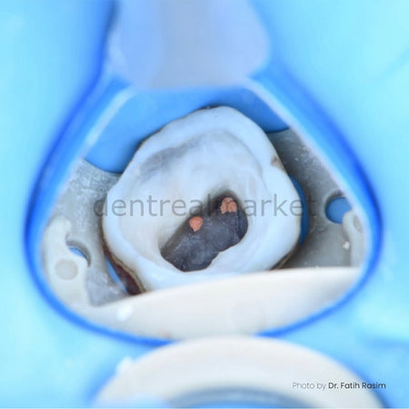 Yirro Comfort Start 4-Piece Mirror Set