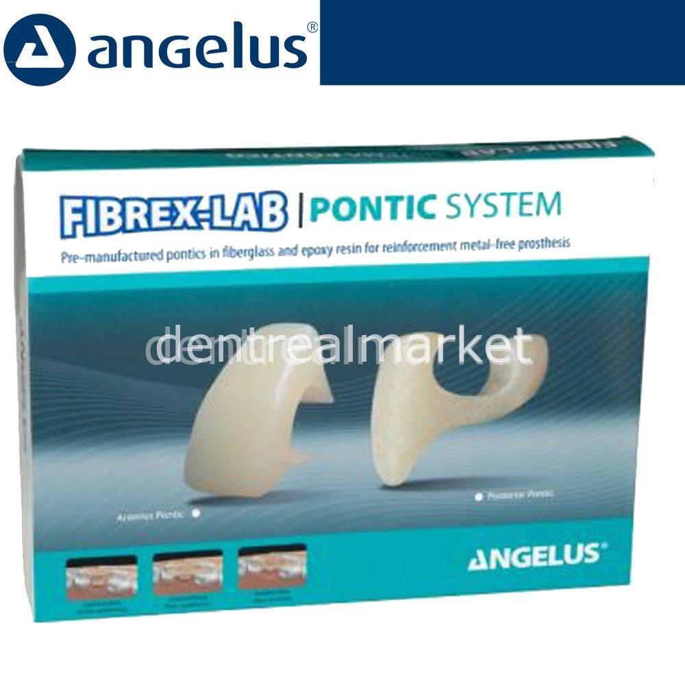 Angelus Fibrex-Lab Pontic System Prefabricated Core Kit