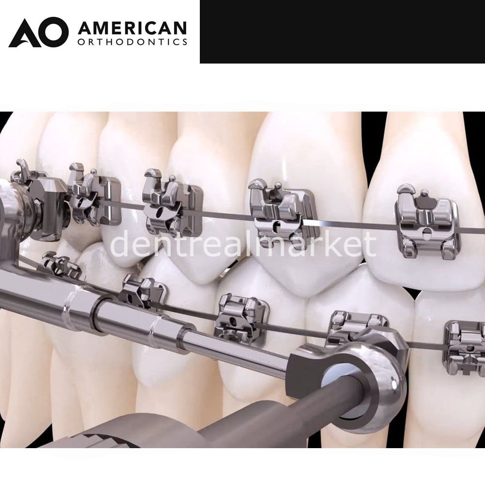 American Orthodontics Power Scope 1 Patient Kit
