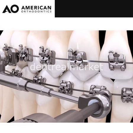 American Orthodontics Power Scope 5 Case Kit