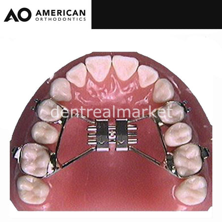 American Orthodontics Mini Rapid Hygienic Expansion Screw