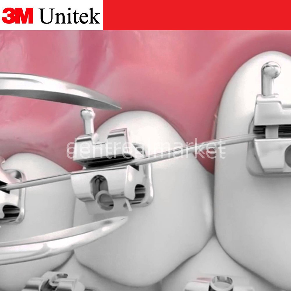 3M Unitek Gemini SL Self-Ligating Metal Bracket