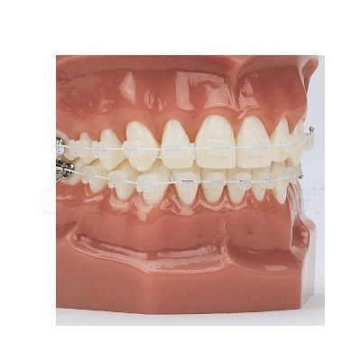 American Orthodontics EverWhite NiTi Cosmetic Round Archwire