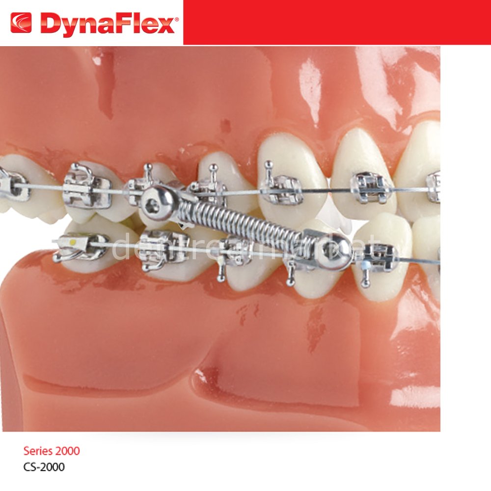 Dynaflex CS5 NiTi Spring