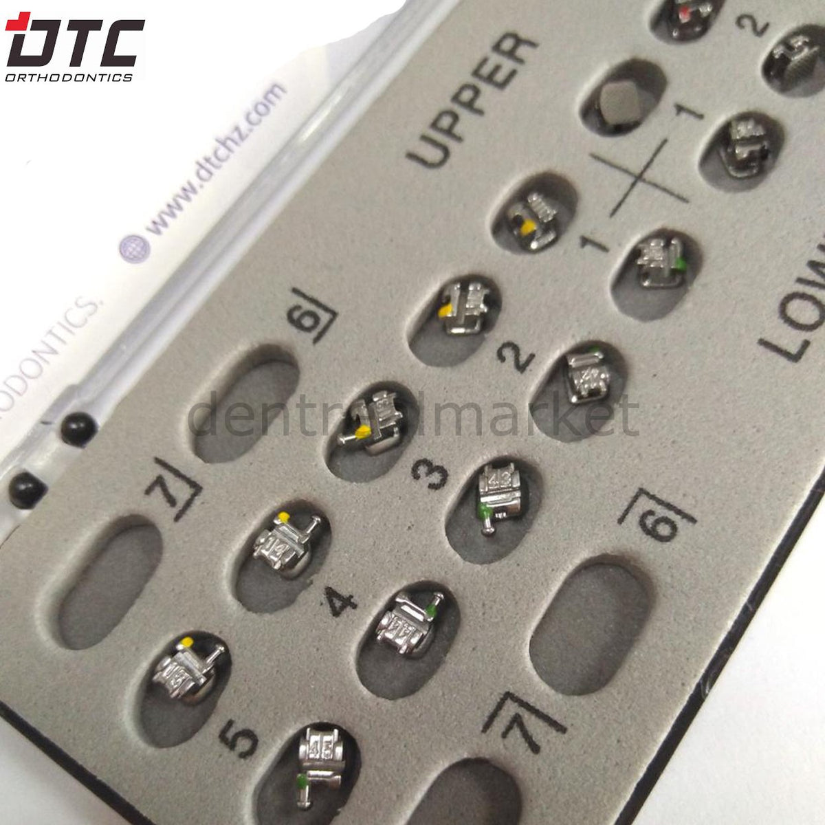 Dtc Orthodontics Glory Self-Ligating Metal Bracket