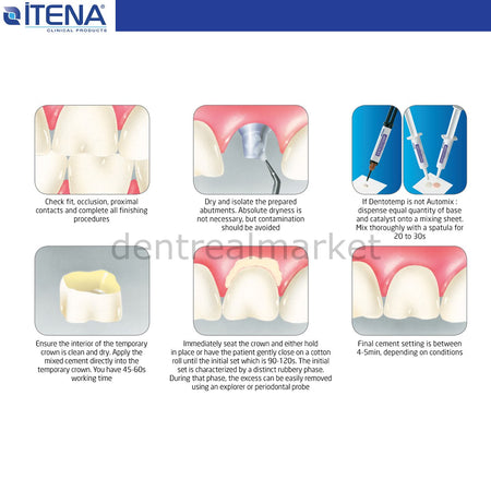 Itena Dentotemp Automix Value Pack Implant Cement 4x6 g