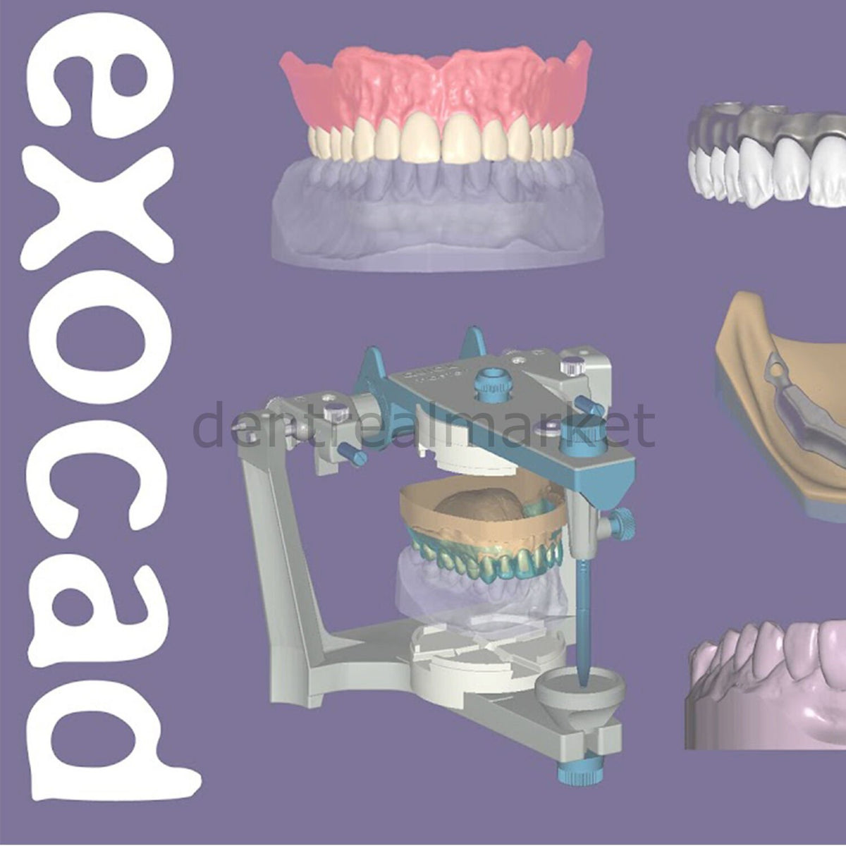 Exocad 3D Dental Design Software – Implant Lab Bundle