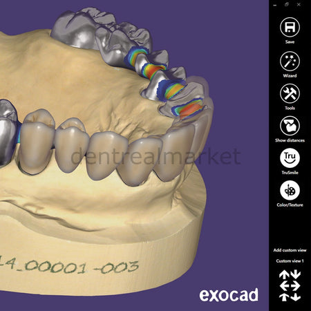 Exocad 3D Dental Design Software — Advanced Lab Bundle