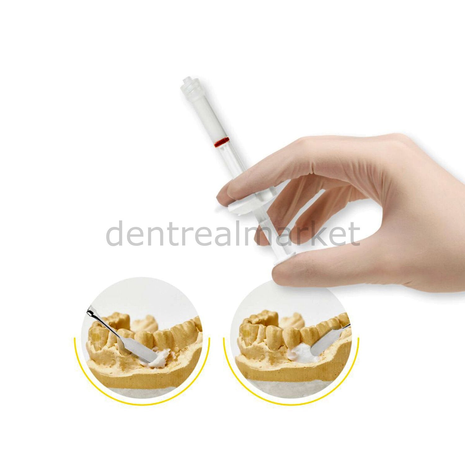 Ghimas Fisiograft HA Paste - Synthetic Bone Biomaterial 2*1ml