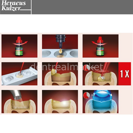 Kulzer GLUMA Self Etch Bond Value Pack