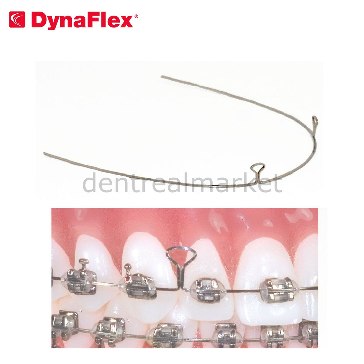 Dynaflex Keyhole Looped Wire Steel 2 Hole