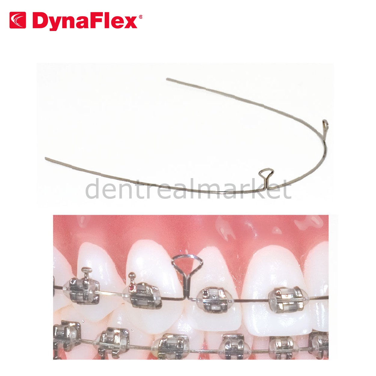 Dynaflex Keyhole Looped Wire Steel 2 Hole