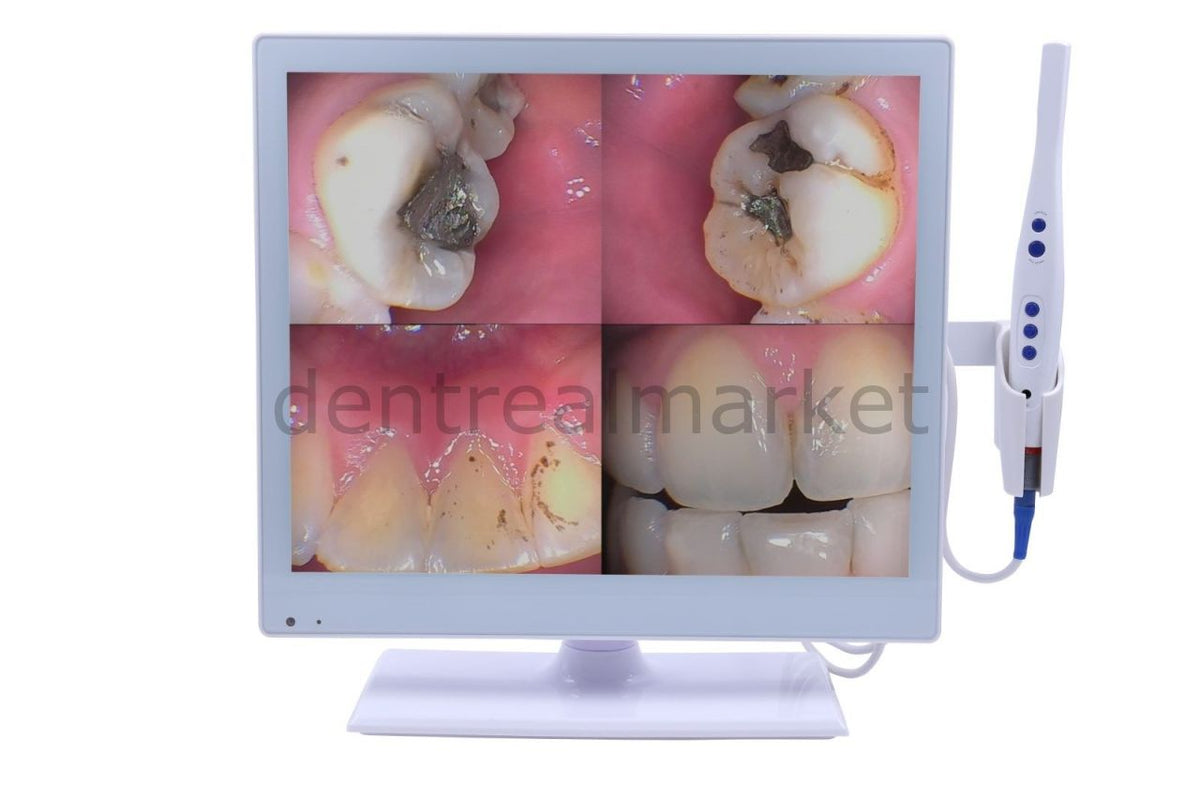 Super Cam M-978 Intraoral Camera and Monitor