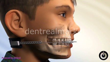 American Orthodontics Eaglewear Cervical Pull Headgear