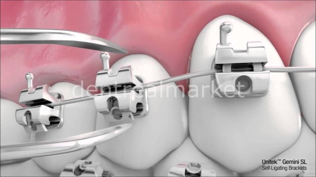 3M Unitek Gemini SL Self-Ligating Metal Bracket