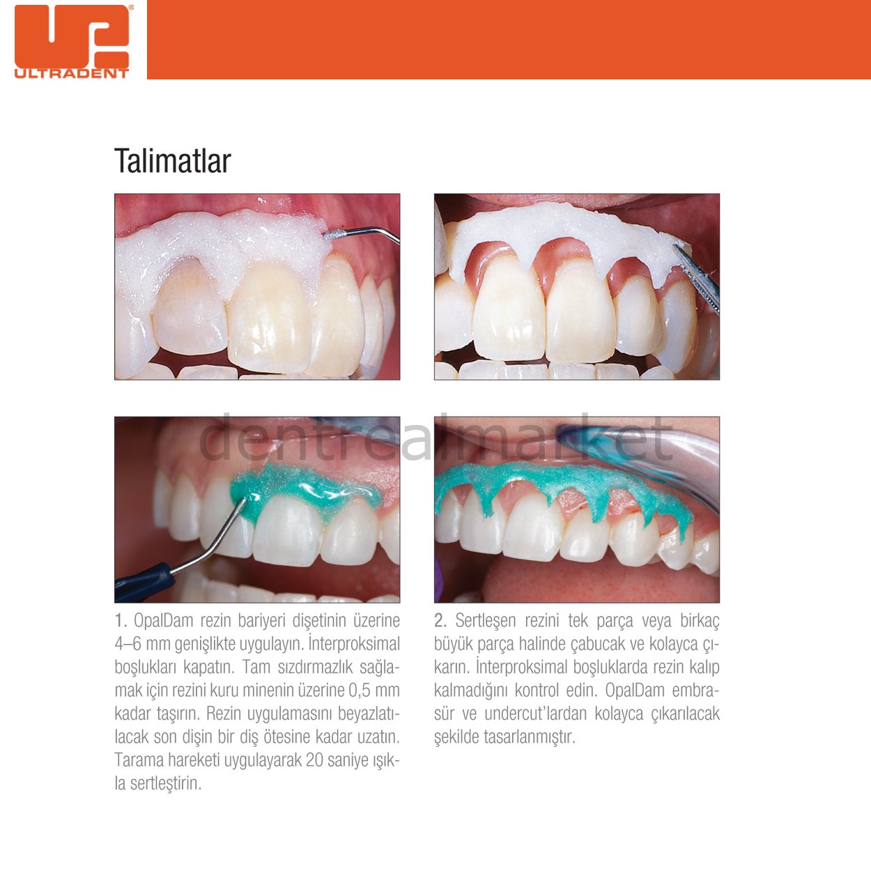Ultradent OpalDam Green Econo Refill — Gingival Protective Barrier