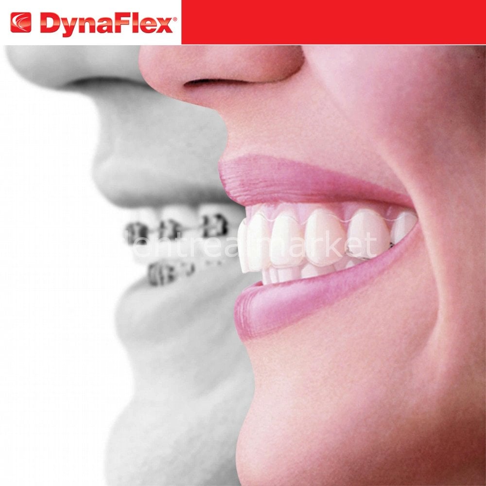 Dynaflex Orthodontic Professional Intro Set