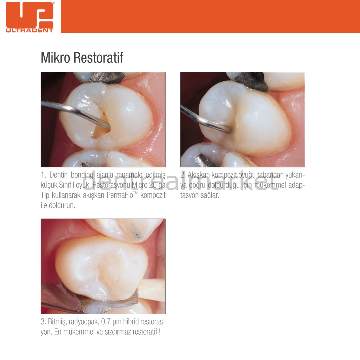 Ultradent PermaFlo Flow Dentin Opaquer Flowable Composite Refill