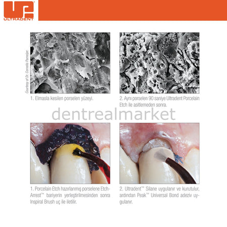 Ultradent Porcelain Etch + Silane Kit