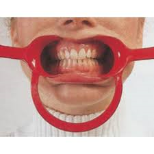 Svenska Mouth Gag Retractor