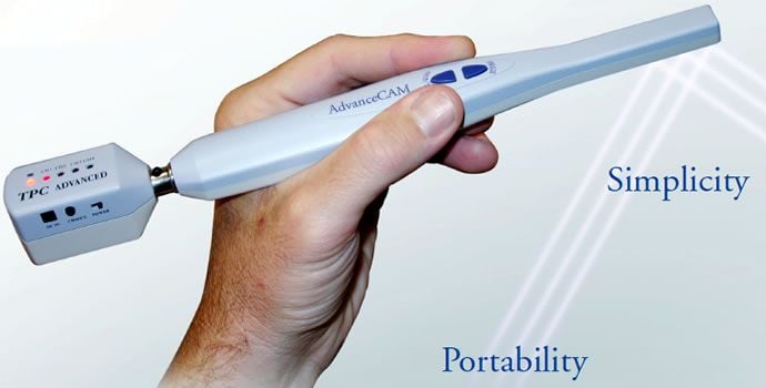 Advance Wireless Intraoral Camera