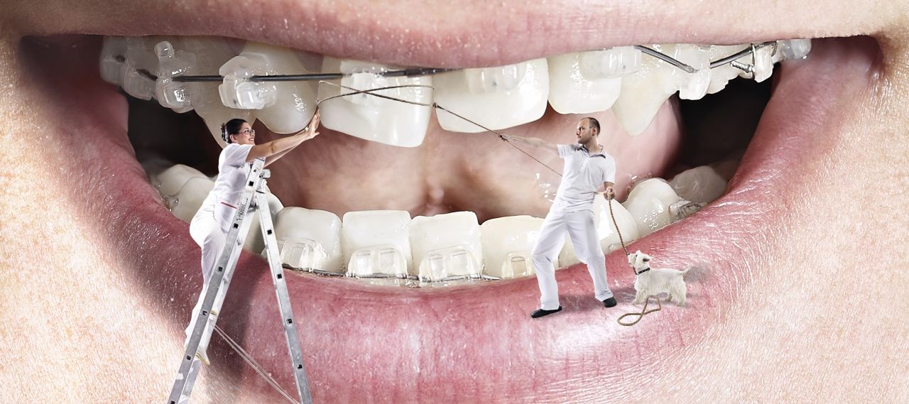 American Orthodontics Orthodontic Starter Kit V3