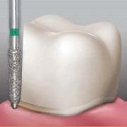 Meisinger 509 Stepped-Cut Synthetic Diamond Bur — Pack of 5