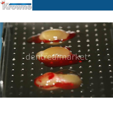 Krowne PRF Processing Instruments