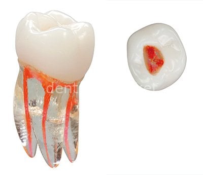 Vdw Training Tooth Molar