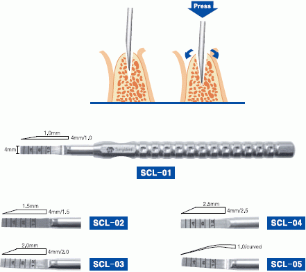 Surgident Ridge Split Chisel Set — SD-RS