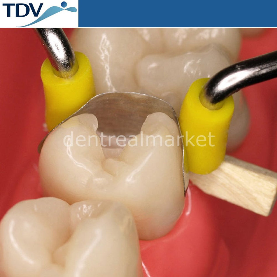 Tdv Dental Unimatrix Matrix Ring