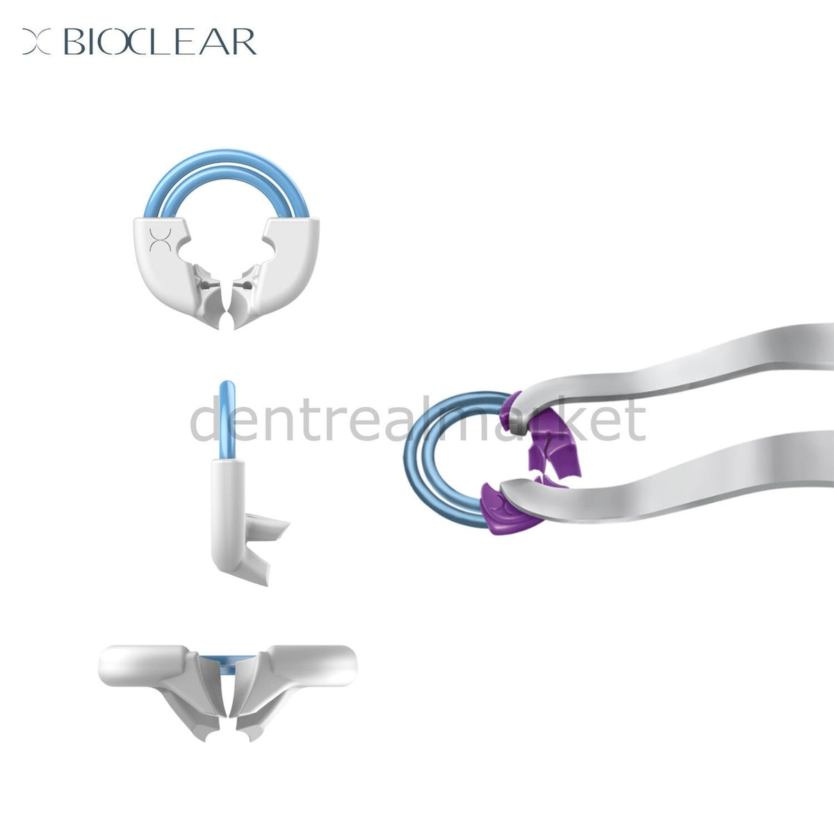 Bioclear TwinRing Universal Ring - Matrix Holder - 1 pc