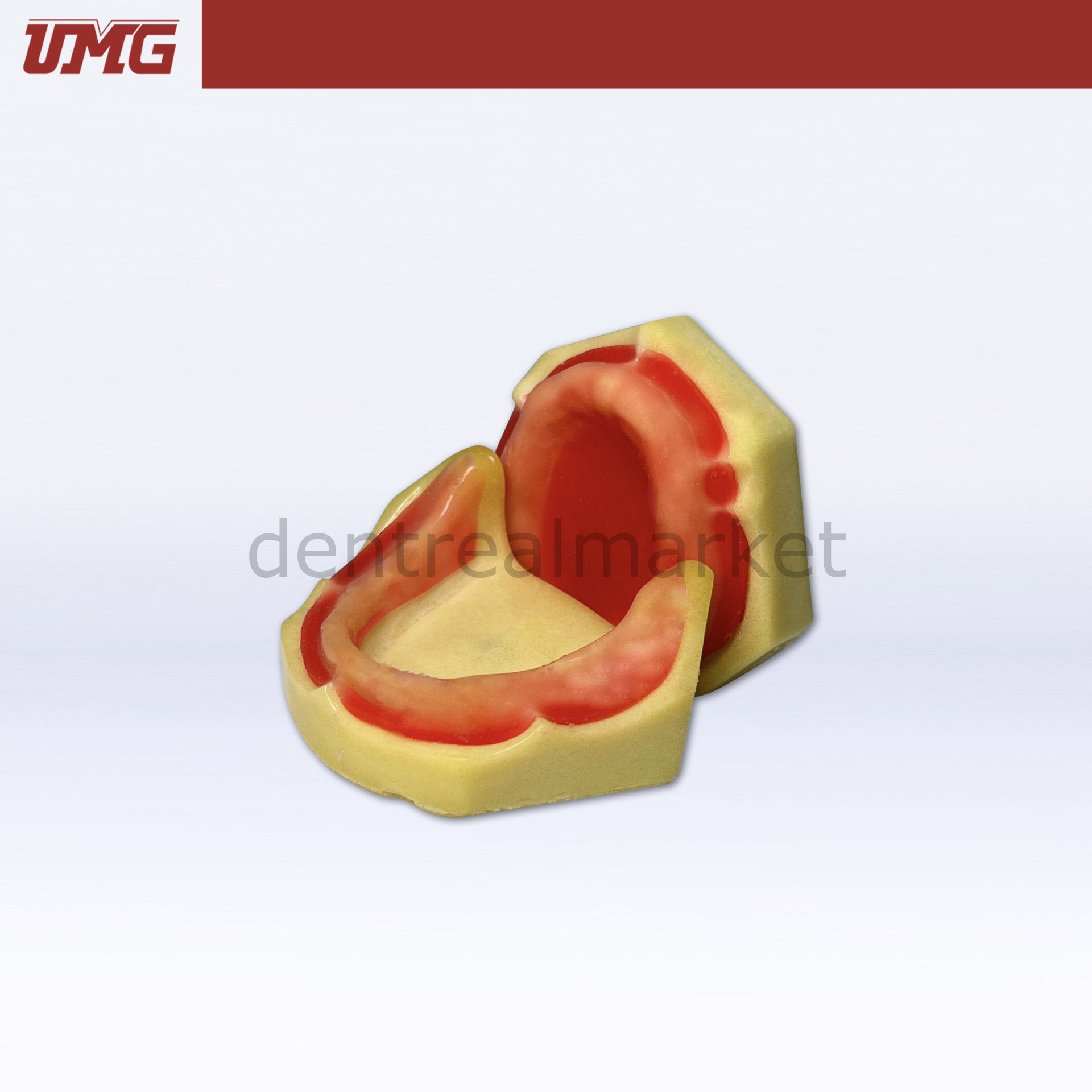 UMG Model Implant Training Model Upper and Lower Set — UM-Z16