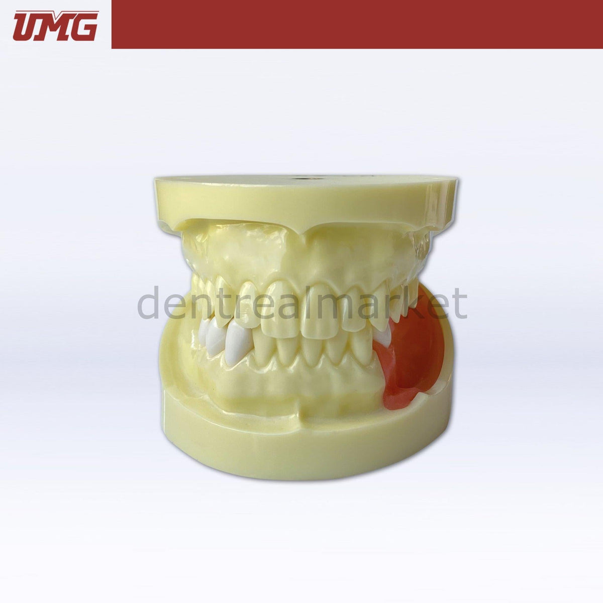 Umgr Ris Umg Dental - Umg Modell Implantat Trainingsmodell Ober-Unterkiefer - UM ...
